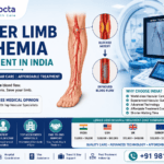 Lower Limb Ischemia Treatment in India