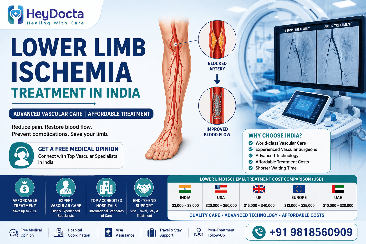 Lower Limb Ischemia Treatment in India