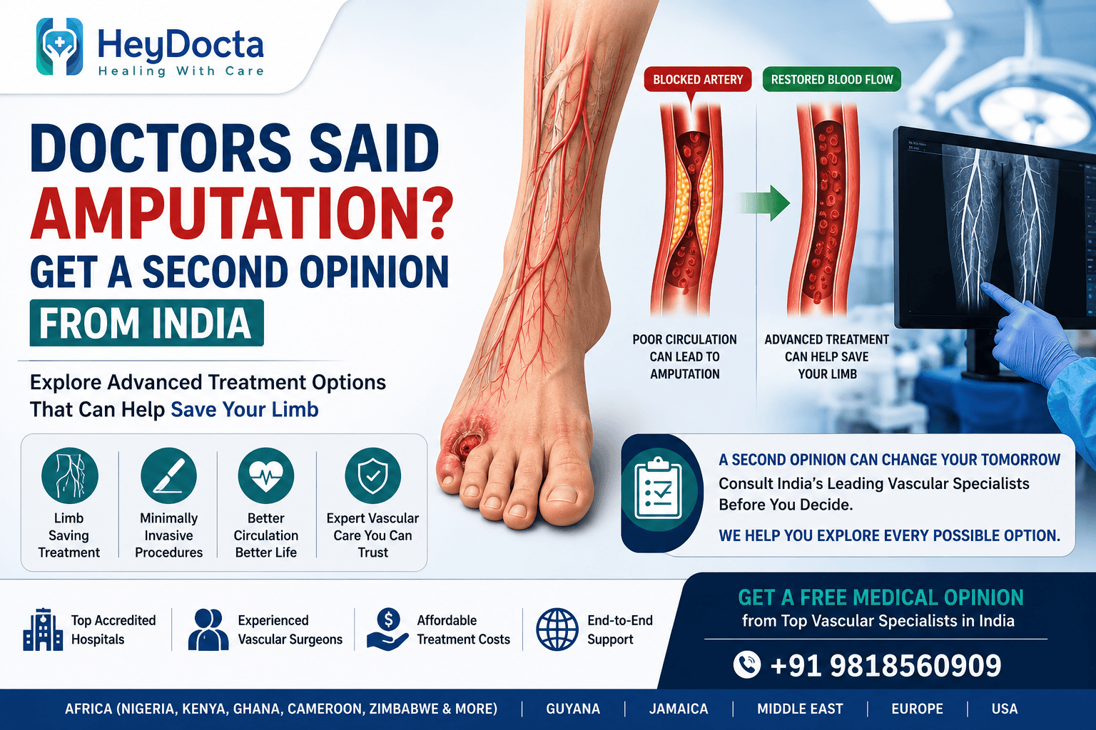 Doctors Said Amputation? Get a Second Opinion from India