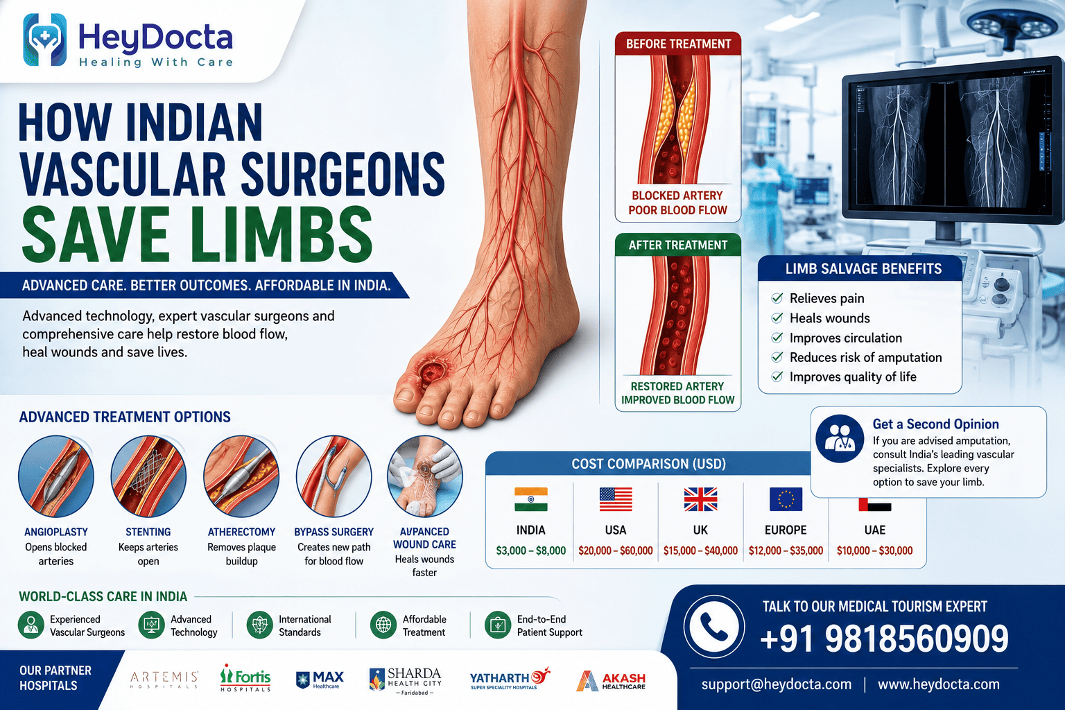 How Indian Vascular Surgeons Save Limbs: Advanced Limb Salvage Treatment
