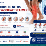 Signs Your Leg Needs Urgent Vascular Treatment