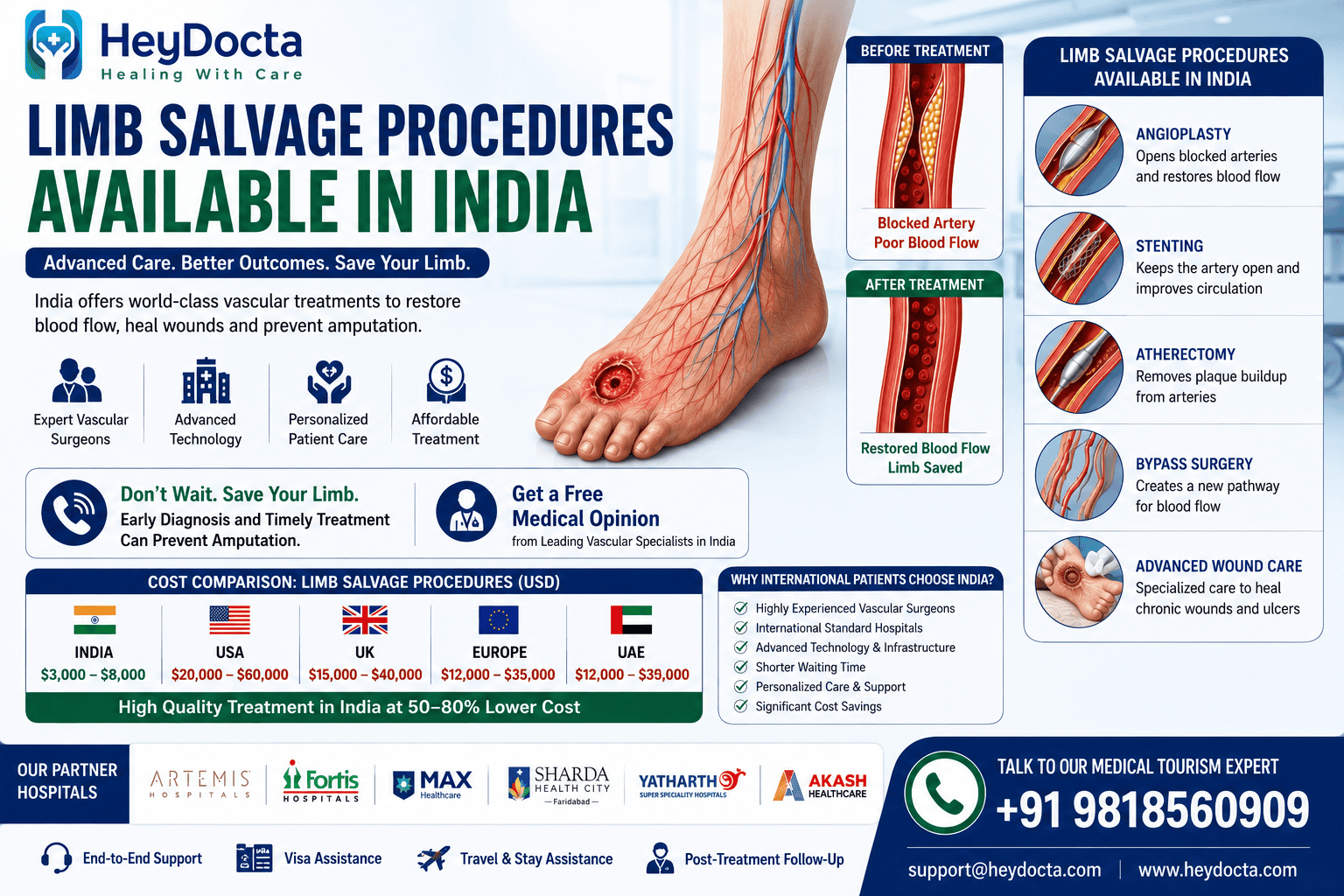 Limb Salvage Procedures Available in India