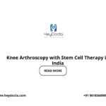 Knee Arthroscopy with Stem Cell Therapy in India