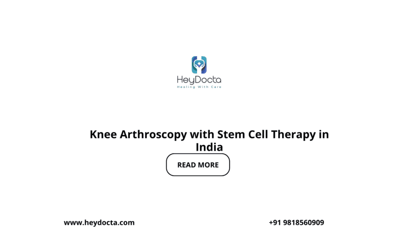 Knee Arthroscopy with Stem Cell Therapy in India