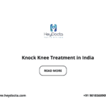 Knock Knee Treatment in India