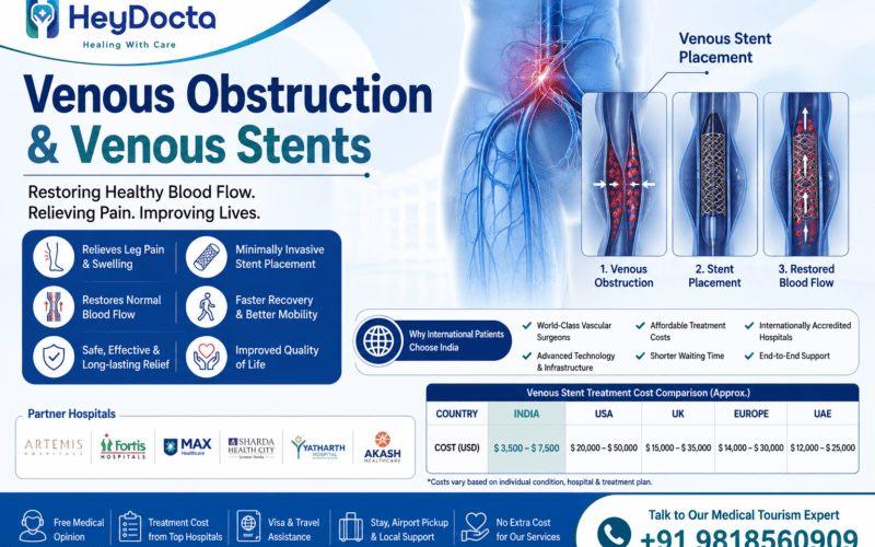 Venous Obstruction & Venous Stents in India