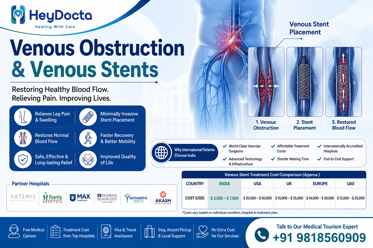 Venous Obstruction & Venous Stents in India