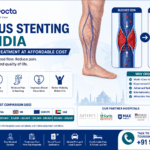 Venous Stenting in India – Advanced Treatment at Affordable Cost