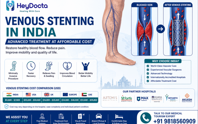 Venous Stenting in India – Advanced Treatment at Affordable Cost