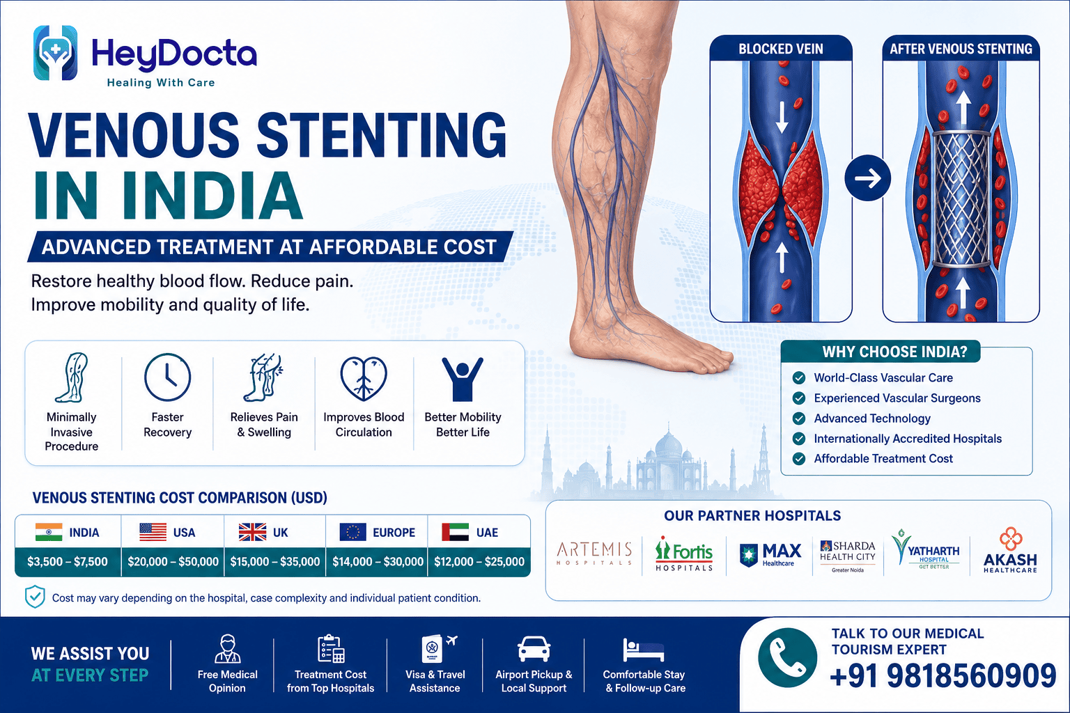Venous Stenting in India – Advanced Treatment at Affordable Cost