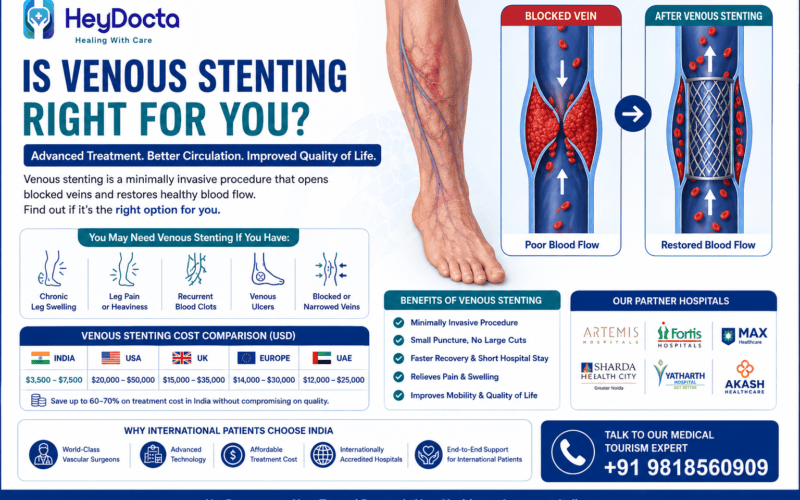 Is Venous Stenting Right for You?