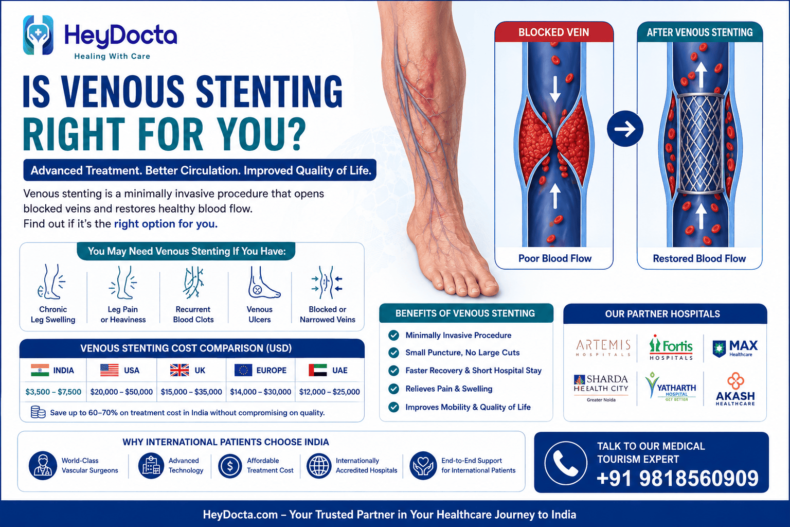 Is Venous Stenting Right for You?