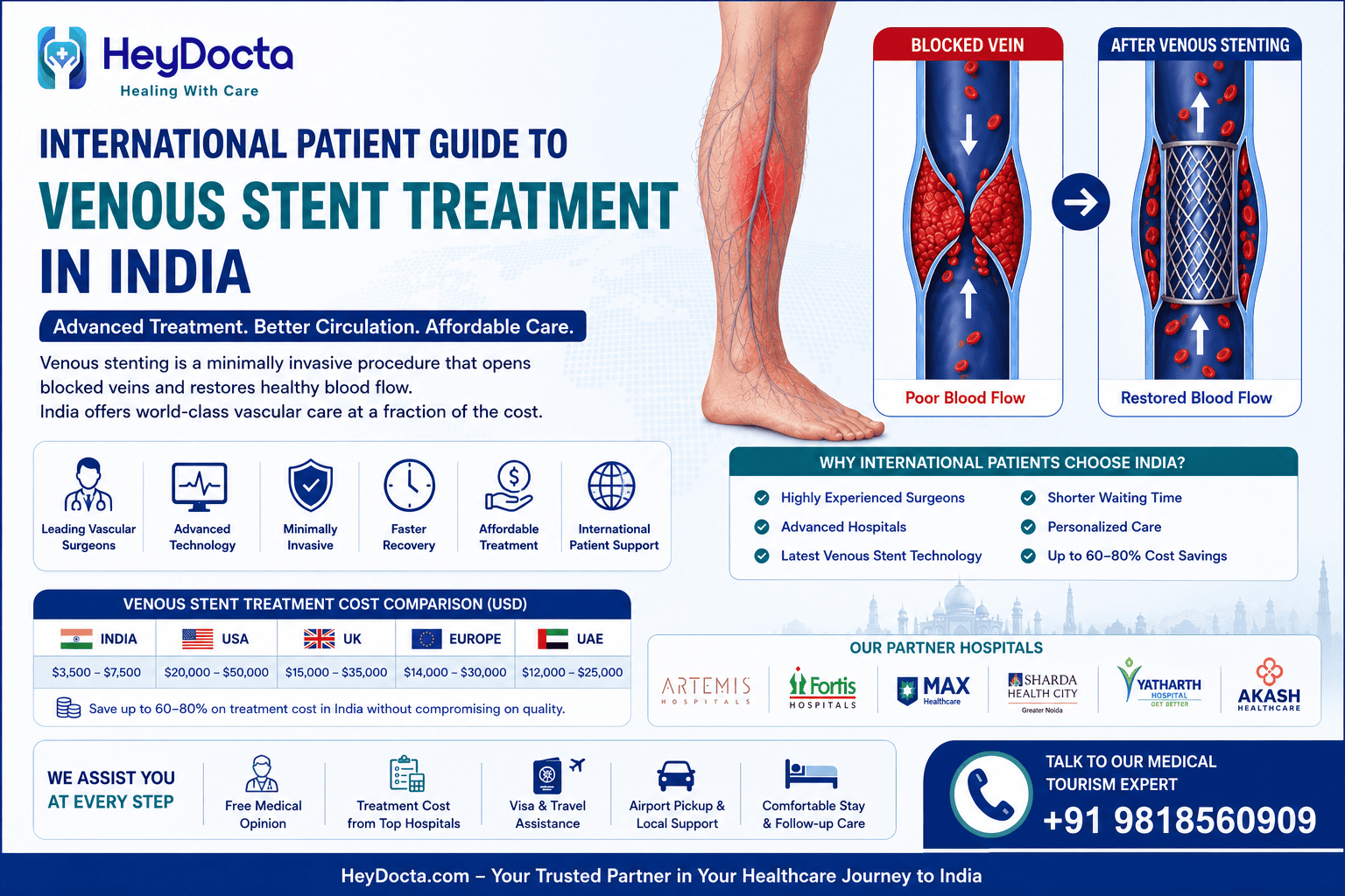 International Patient Guide to Venous Stent Treatment in India