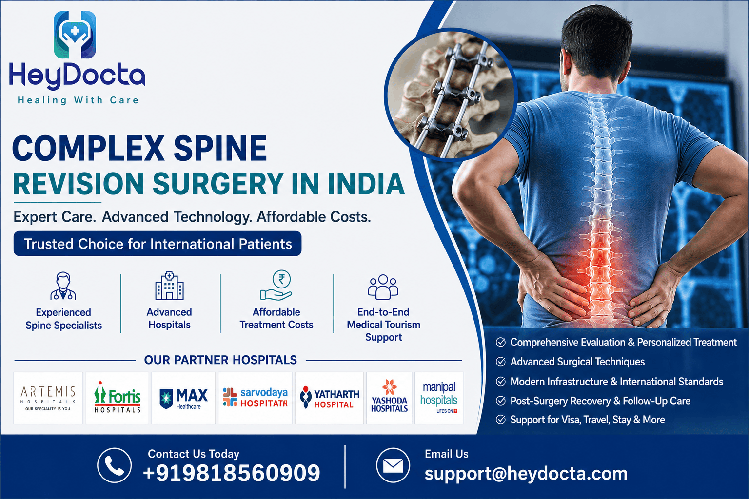 Complex Spine Revision Surgery in India