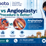 CABG vs Angioplasty: Which Procedure Is Better?