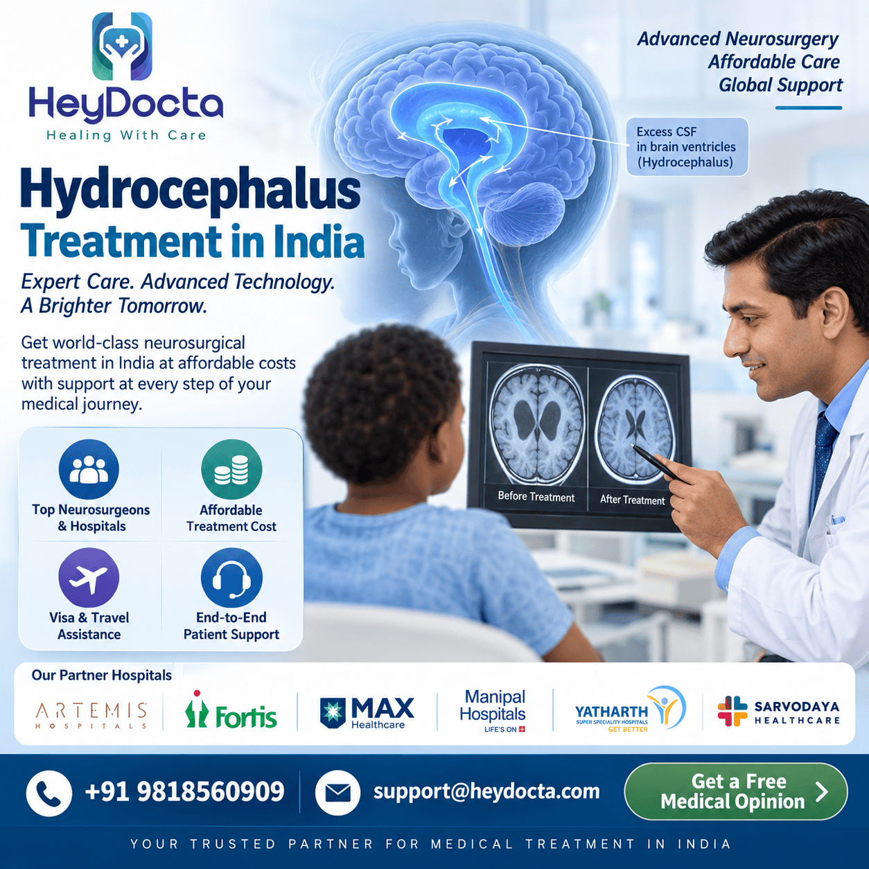 Hydrocephalus Treatment in India
