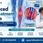 Advanced DVT Treatment in India
