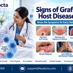 Signs of Graft-versus-Host Disease (GVHD)