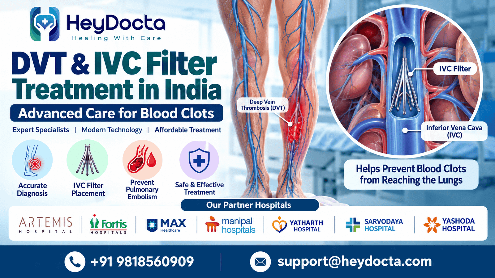 DVT and IVC Filter Treatment in India