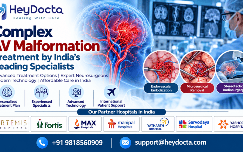 Complex AV Malformation Treatment in India