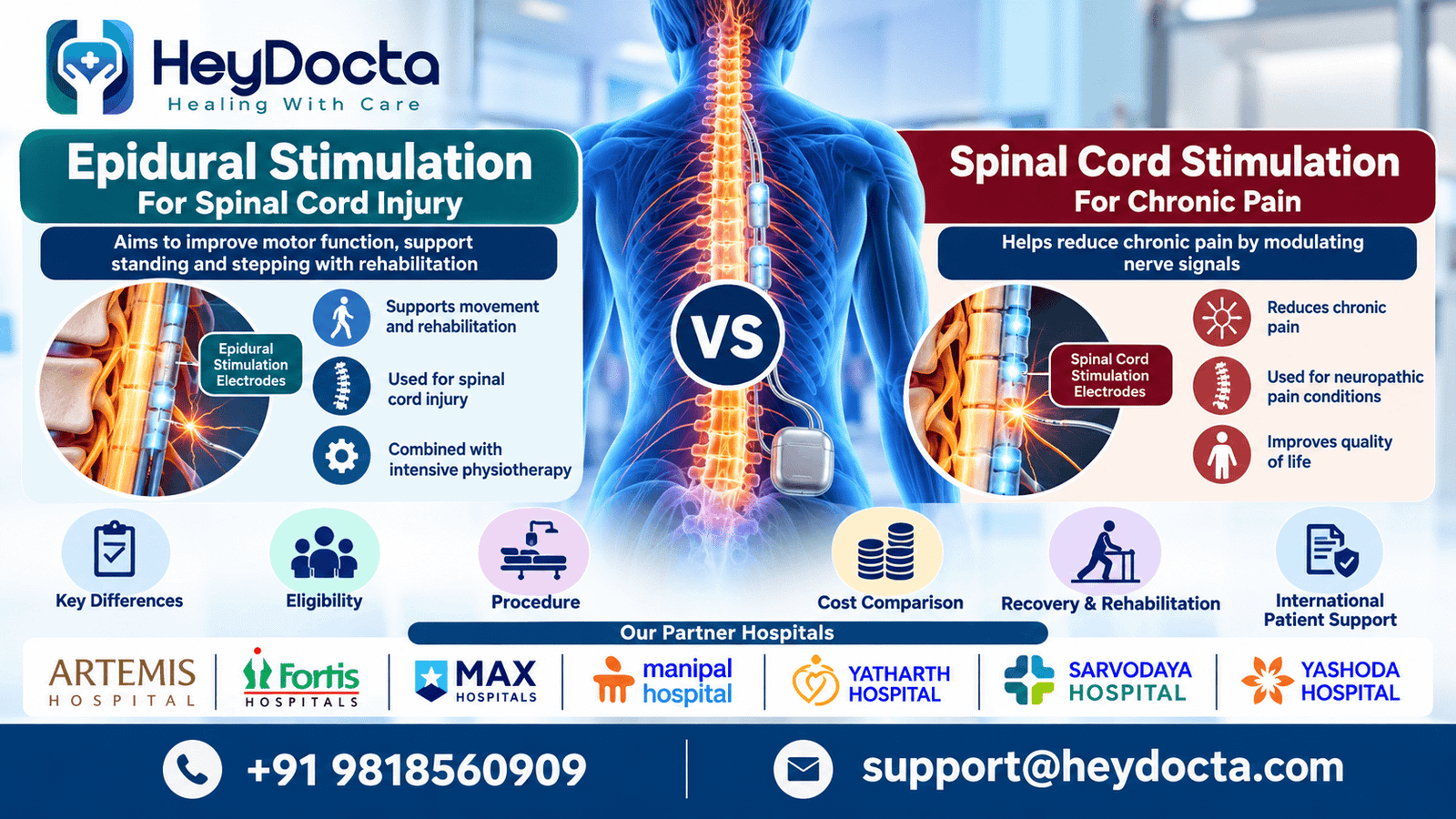 Epidural Stimulation vs Spinal Cord Stimulation