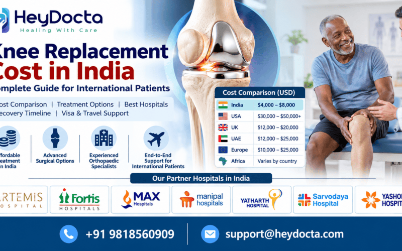 Knee Replacement Cost in India