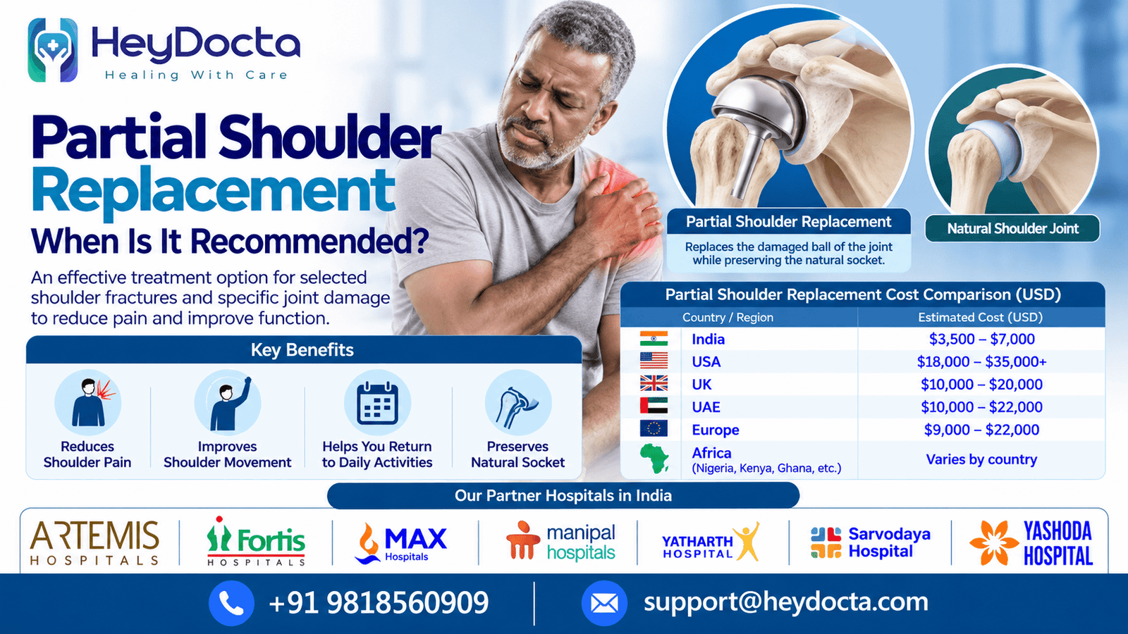 Partial Shoulder Replacement: When Is It Recommended?