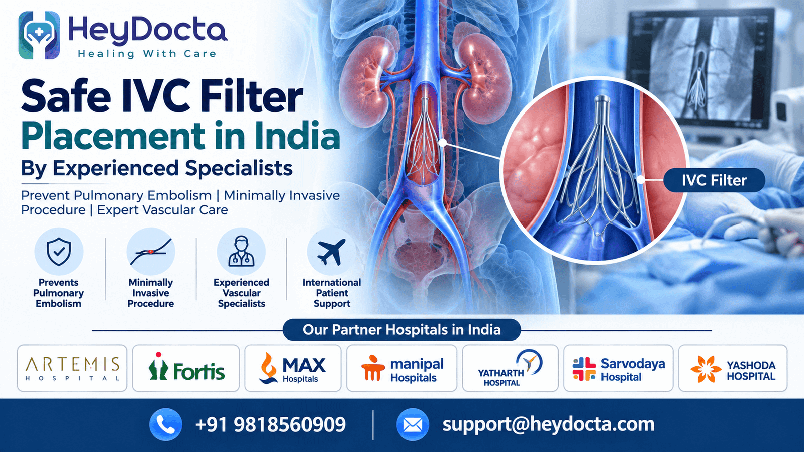 Safe IVC Filter Placement in India